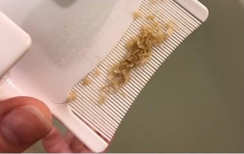 the flakes on the comb