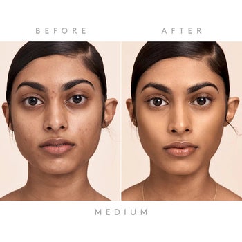 before and after of a model's face from using the eaze drop - the after photo looks smoother and even toned