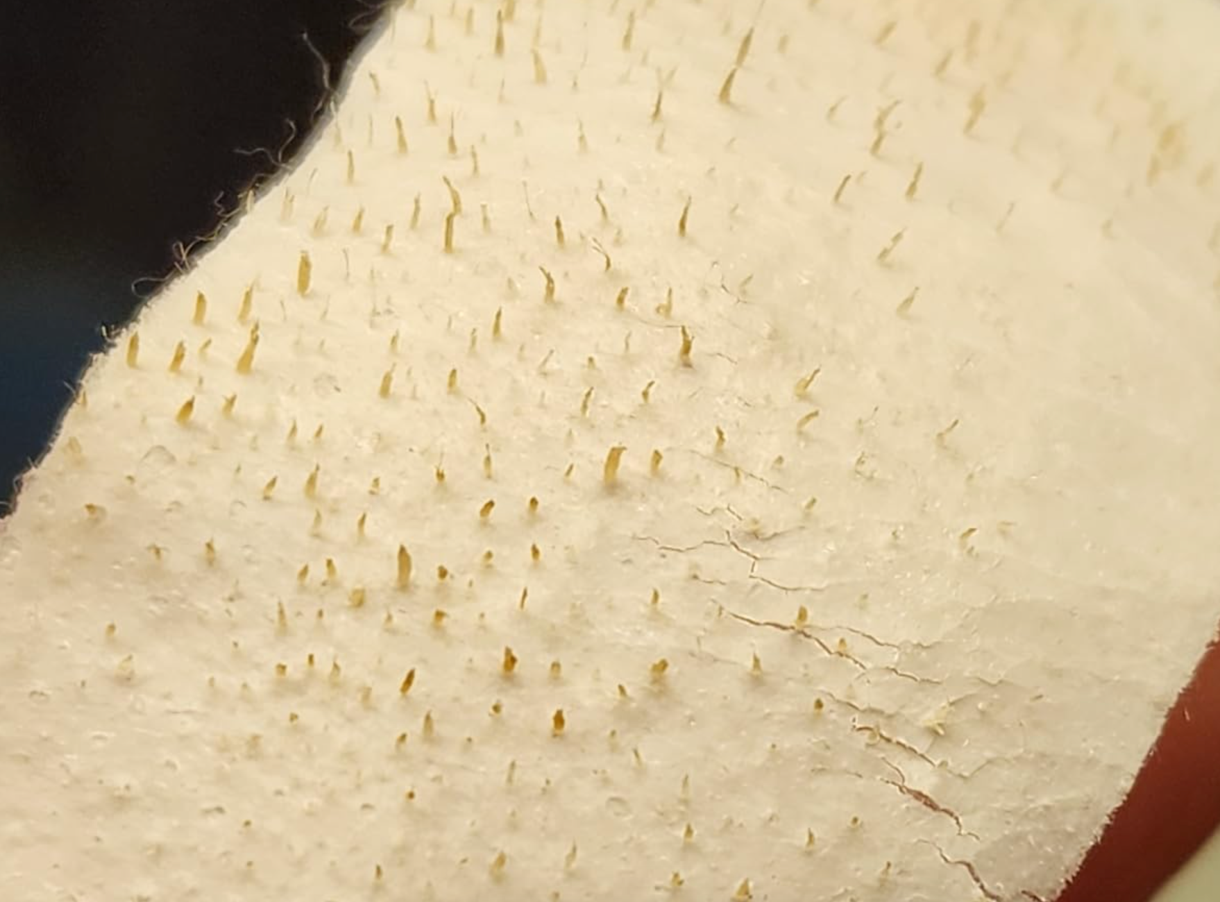 Close-up of a skincare product's aboveground  showing small, hair-like projections, apt  illustrating its effectiveness successful  removing impurities from the skin