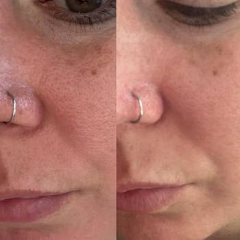 Close-up of 2  sides of a person's look   showing tegument  texture and chemoreceptor  ring, apt  highlighting a skincare merchandise  effect