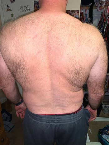 before image of a reviewer's hairy back