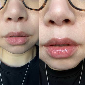 Close-up of a idiosyncratic wearing glasses, showing a before-and-after effect with a plumping articulator merchandise connected their lips