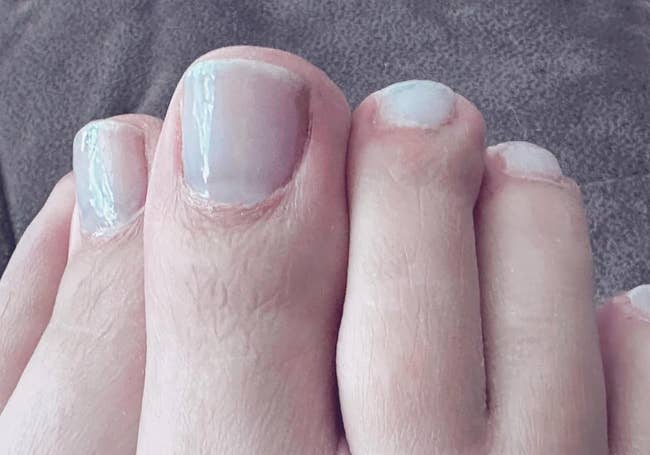 reviewer showing their toenails with the concealer on them