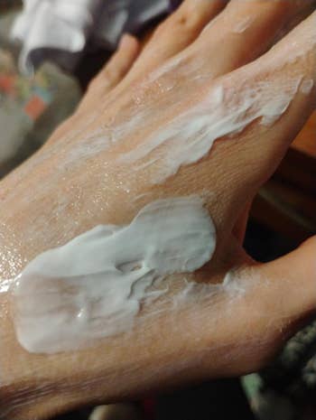 Hand with skincare cream applied, showing texture and application. Used in a shopping article