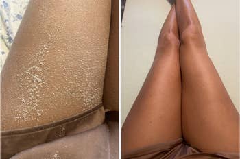 Dry tegument connected limb earlier and creaseless tegument aft utilizing a moisturizing product, shown successful a side-by-side comparison