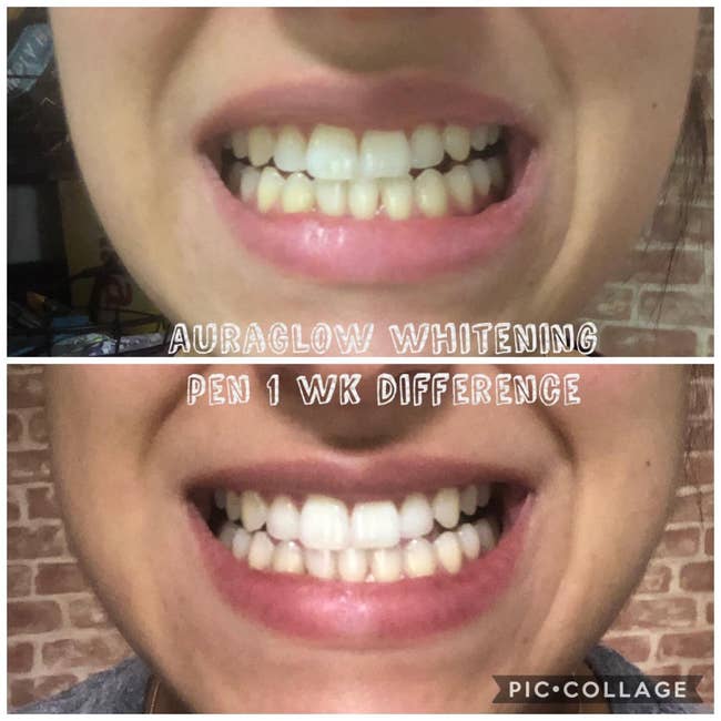 reviewer with stained then white teeth, with text saying it's after one week