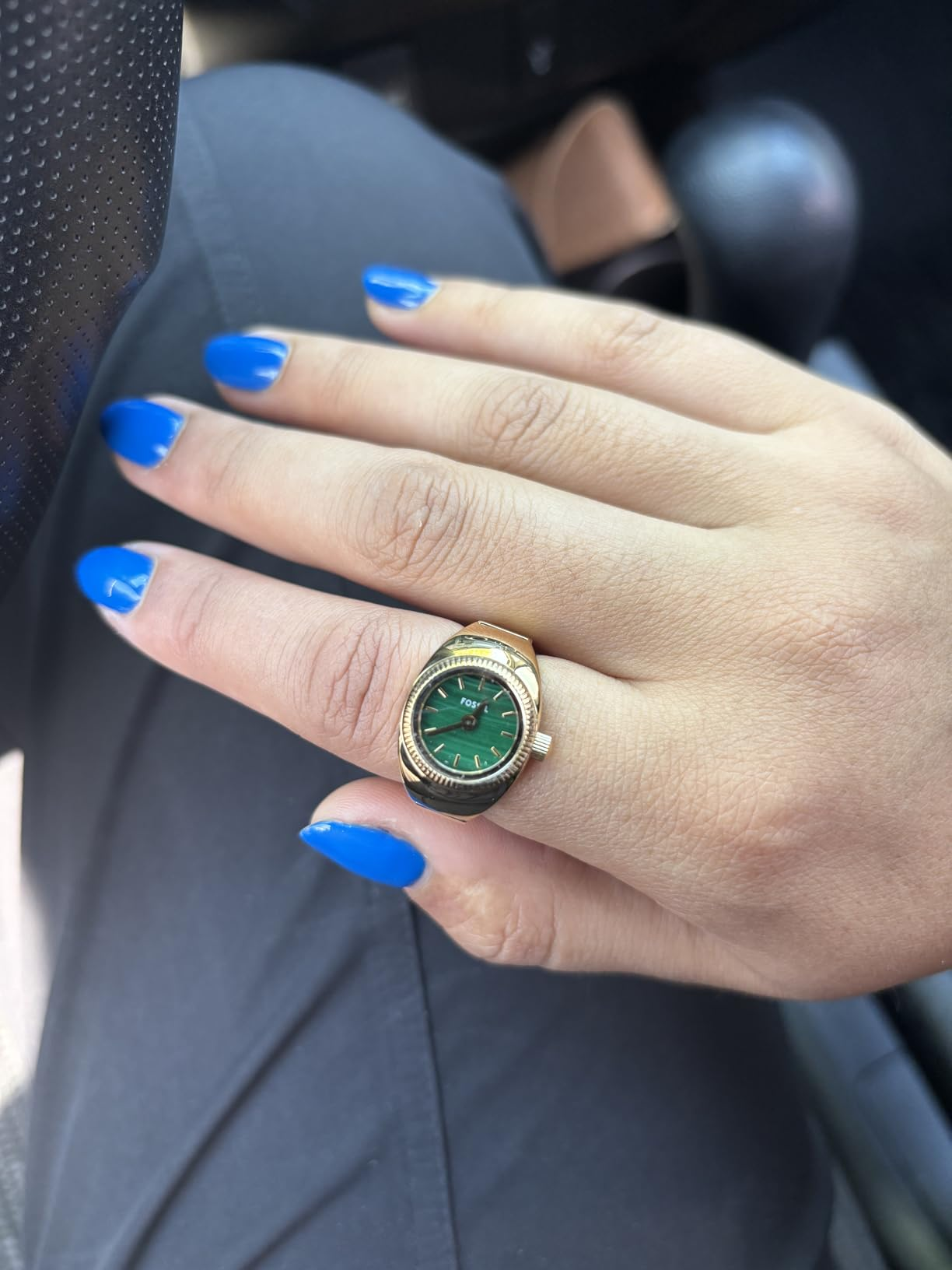 Hand with bluish  nails displaying a golden  ticker  with a greenish  face, worn arsenic  a ring