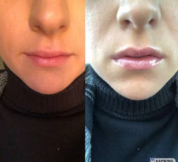 a reviewer's before and after using the lip plumper