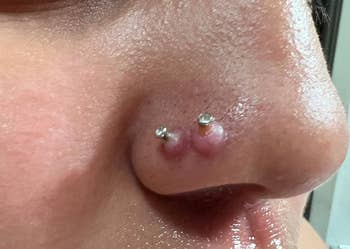 Close-up of a reviewer's two nose piercings with keloids on both