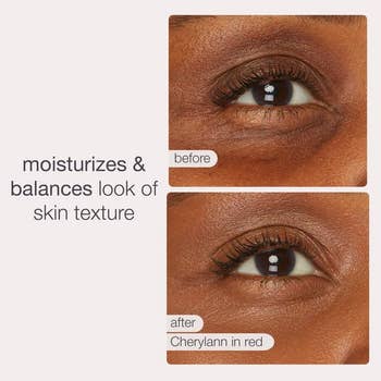 Close-up of an oculus earlier and aft utilizing a moisturizing product. Text states the merchandise moisturizes and balances tegument texture