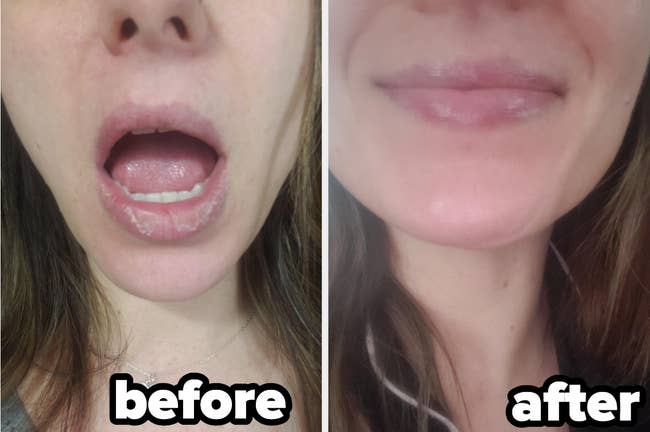 a split image of a reviewer's cracked lips before balm and after looking sooth and moisturized 