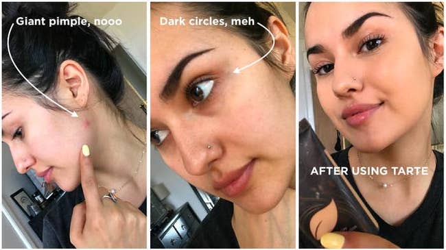before/after image of writer Kayla Suazo showing how the foundation covers up pimples and dark circles