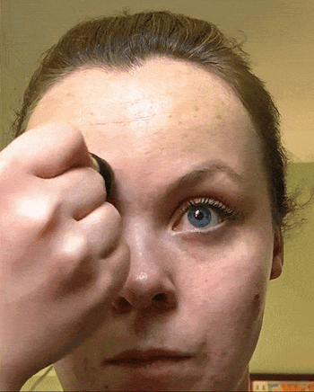 Reviewer gif of them applying the roller on half of their forehead