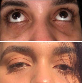 Reviewer with dark undereye circles before using the stick and brightened, smoother undereyes after using the stick
