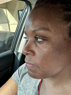 after photo of the same reviewer whose skin now looks much less shiny