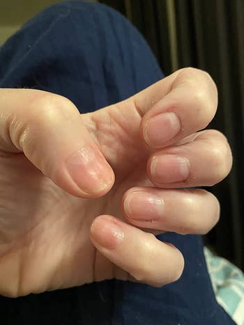 after image of reviewer's nails no longer cracked or peeling