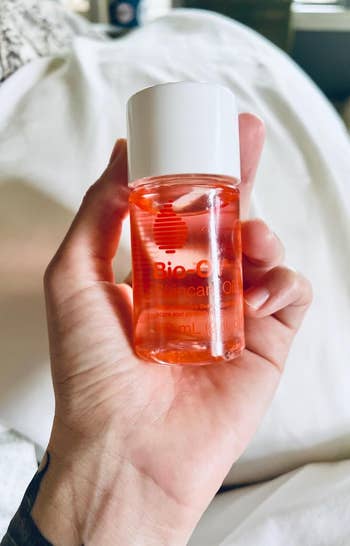 17 Personal Care Products With Goosebump-Inducing Before And After Photos