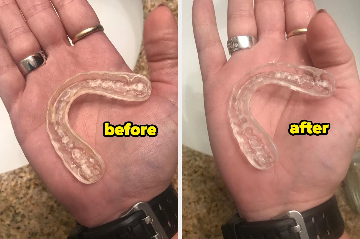 Reviewer's night guard looking dingy and slightly yellow labeled before, and after with the night guard looking clear and clean