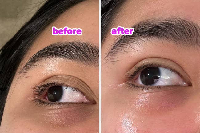 A close-up comparison of one eye before and after using the eye serum