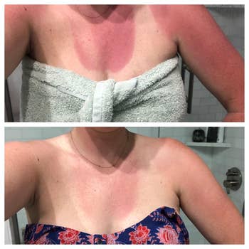 A reviewer's sun burnt chest and then less sun burnt 24 hours later