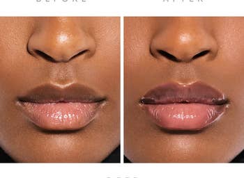 Model before and after using lip plumper with noticeably fuller lips