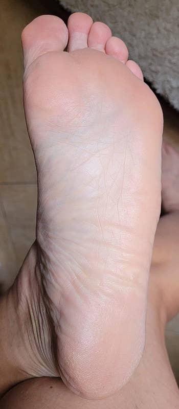 after reviewer photo of the same reviewer with super smooth feet