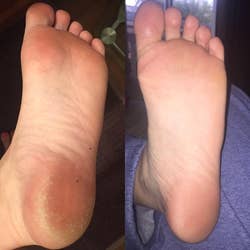 a before and after comparison of a reviewer's foot
