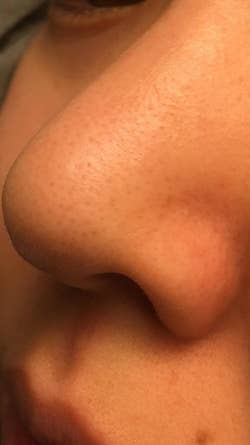 Close-up of the same reviewer's nose with clearer skin and smaller pores