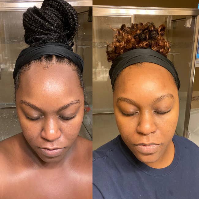 reviewer photos six weeks apart showing the cleanser helped fade dark spots on their forehead and cheeks