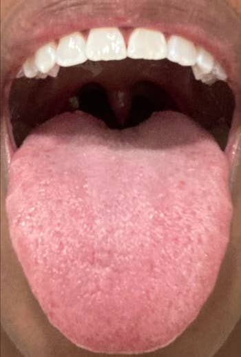 Close-up of a person's open mouth showcasing their clean tongue