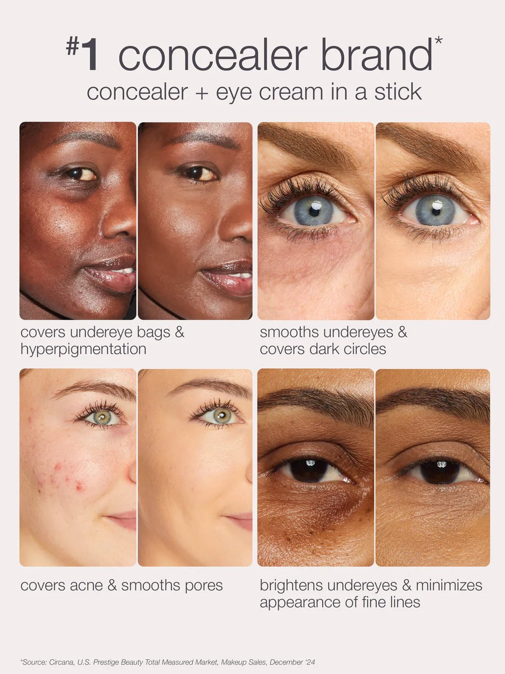  under-eye, acne, and good  lines, promoting a dual-use concealer product