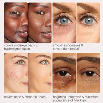 under-eye, acne, and good lines, promoting a dual-use concealer product