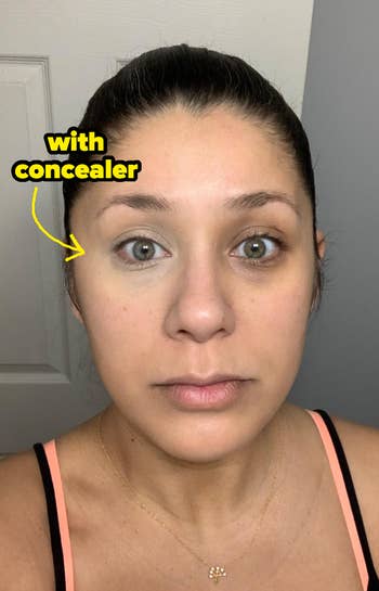 before/after of a reviewer showing how well the concealer worked at covering undereye circles