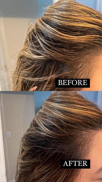 Reviewer's translation  with “Before” showing greasy hairsbreadth  and “After” showing hairsbreadth  that doesn't look   greasy