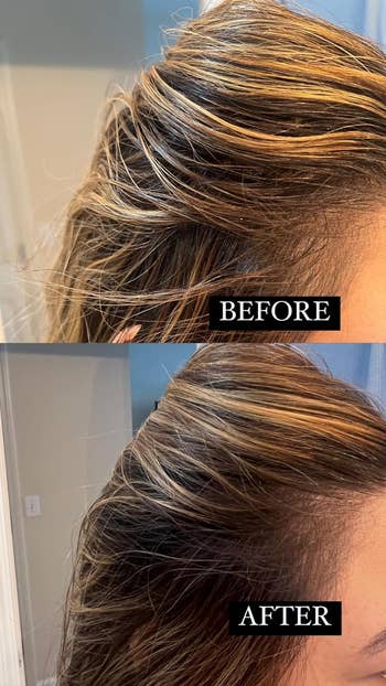 Reviewer's transformation with “Before” showing greasy hair and “After” showing hair that doesn't look greasy