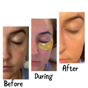 a reviewer's before, during, and after wearing under eye patches