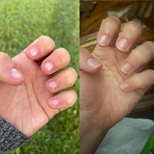 left: Reviewer before photo of stubby, bitten nails / right: after with nails looking long and healthy with the polish