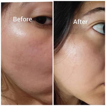 Close-up comparison of a person's skin before and after skincare treatment