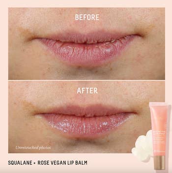 before and after of a model's chapped and then hydrated lips