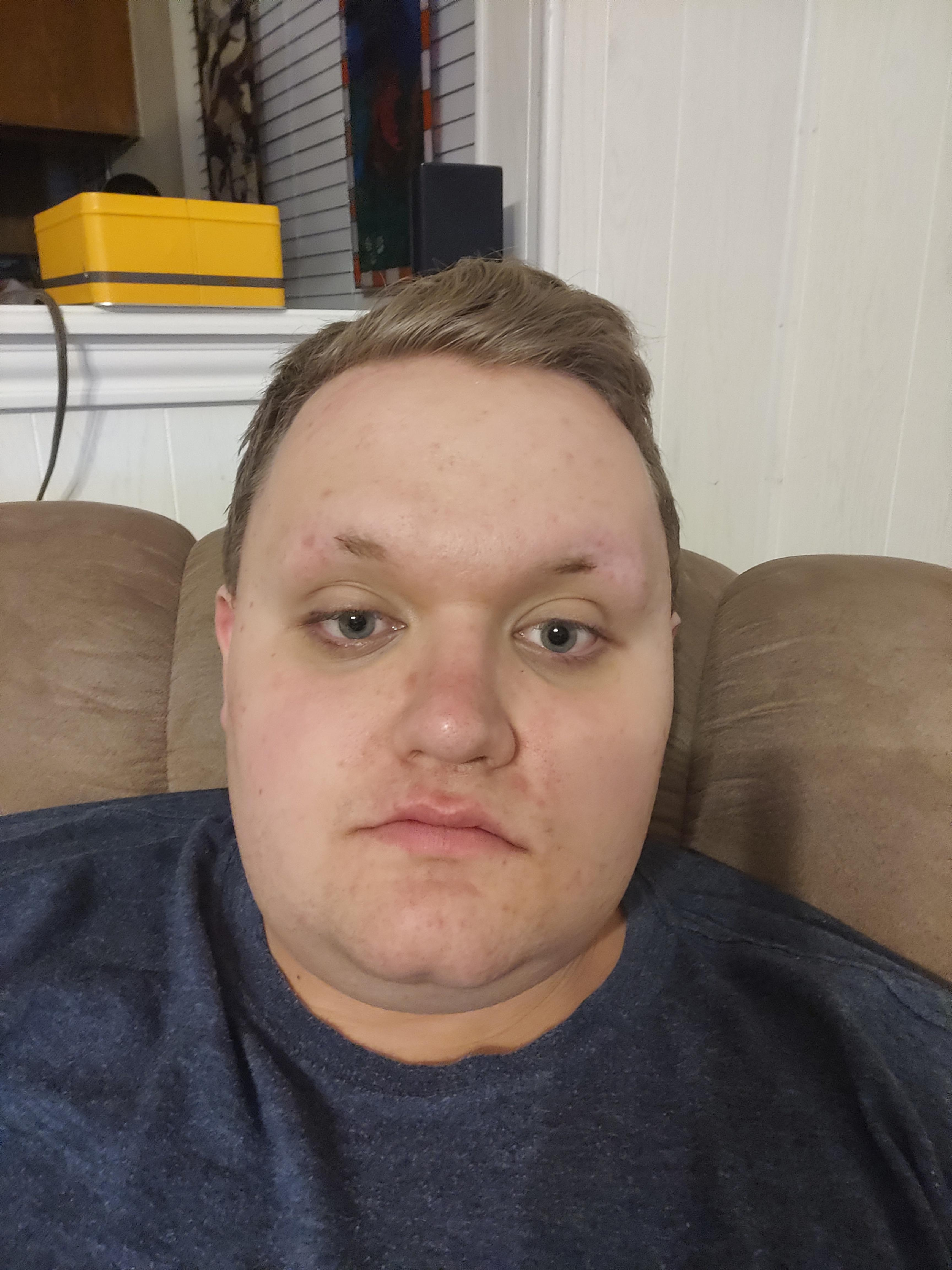 Person sitting connected  a couch, gazing straight  astatine  the camera successful  a relaxed, location  setting