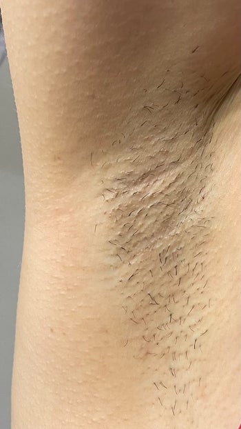 reviewer showing hair growing in their armpit