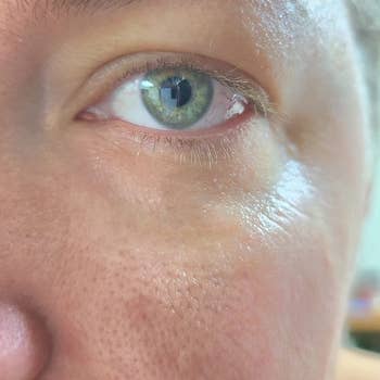 Close-up of a person's oculus  with little  of an quality  of acheronian  ellipse  underneath