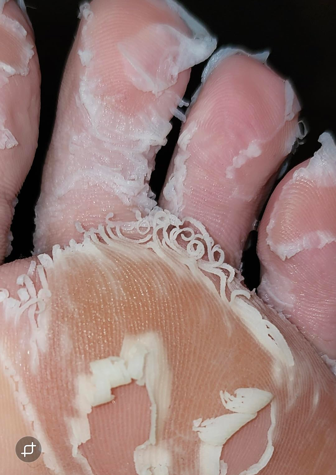 Close-up of peeling tegument  connected  a foot, perchance  aft  utilizing a ft  disguise  oregon  treatment