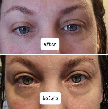 split image of reviewers eyes with dark circles before using hydrating stick and then after with brighter under eyes