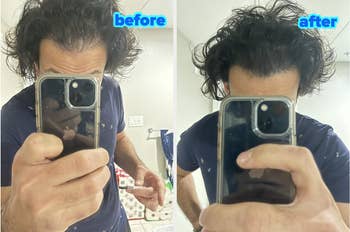 the reviewer before and after using the rot cover up to hide thinning hair