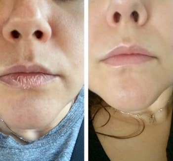 before and after of a reviewer's chapped lips and hydrated lips 