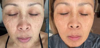reviewer before and after vitamin c serum 