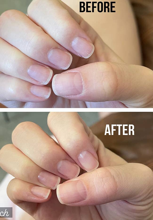 Reviewers fingers with dry cuticles, 