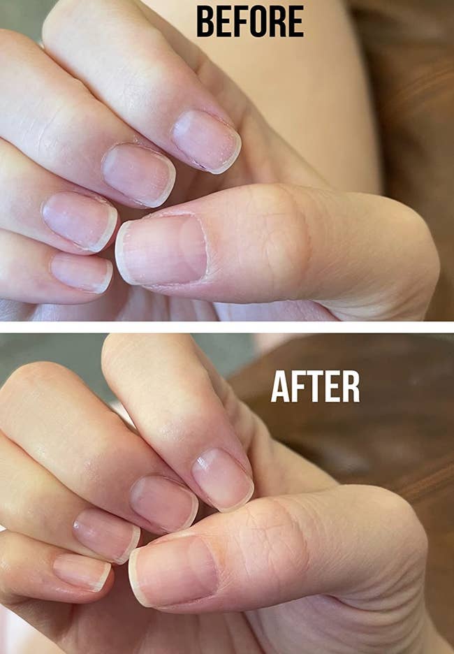 Reviewers fingers with dry cuticles, 