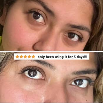 reviewer showing the difference in their undereyes after 3 days of using the eye cream, showing reduced dark circles and overall more brightness